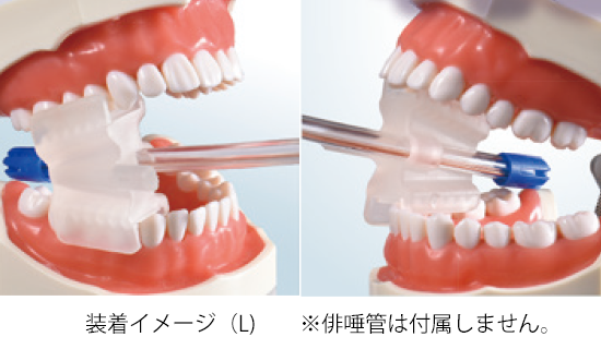 サクションホールドブロック