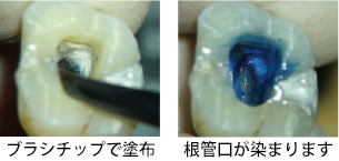 使用例