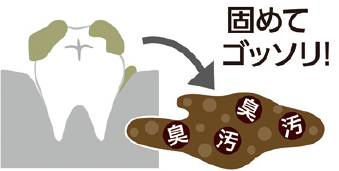 固めてゴッソリ！