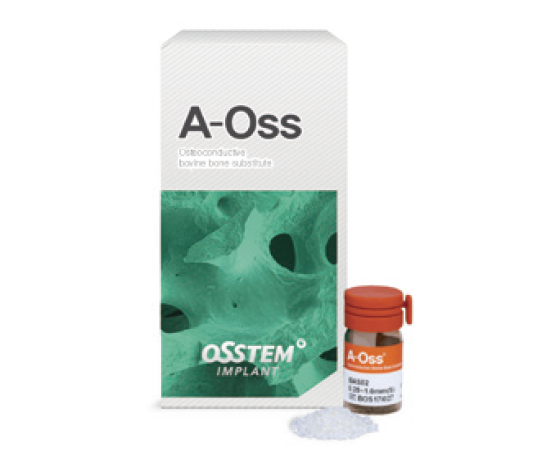 A-Oss