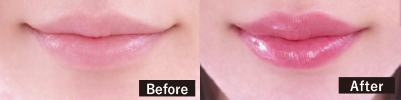 Before After