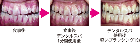 使用例