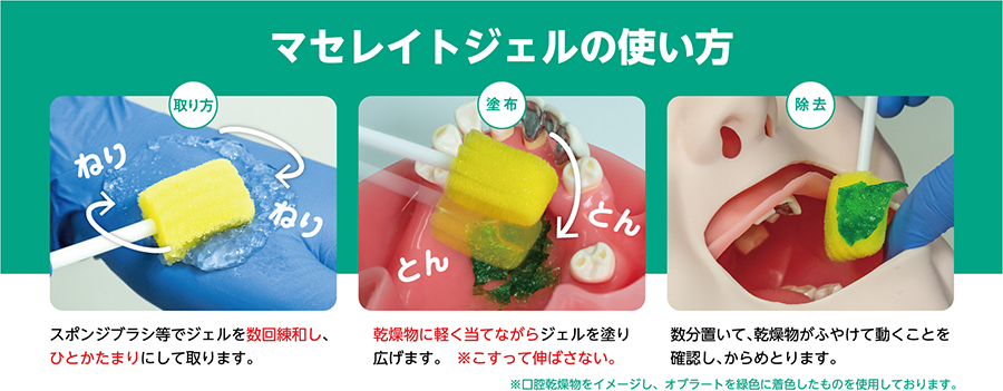 マセレイトジェルの使い方