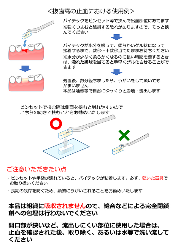 抜歯窩の止血における使用例