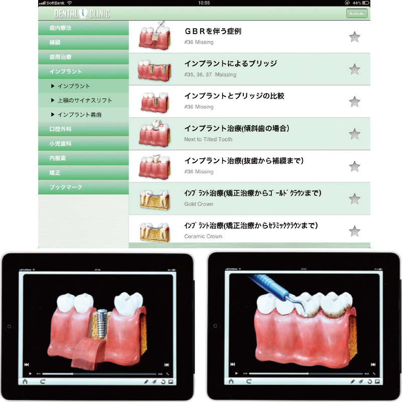 Ipadアプリ Dental I Clinic の通販 Ciモール Ciモール